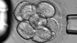 New Test Will Increase IVF Success, Reduce Multiple Births